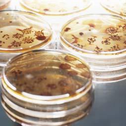 Attributing U.S. Campylobacteriosis Cases To Food Sources • Cover image of Attributing U.S. Campylobacteriosis Cases to Food Sources, Season, and Temperature