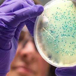 Thumbnail Err 297 Cover image of Updating Economic Burden of Foodborne Diseases Estimates for Inflation and Income Growth